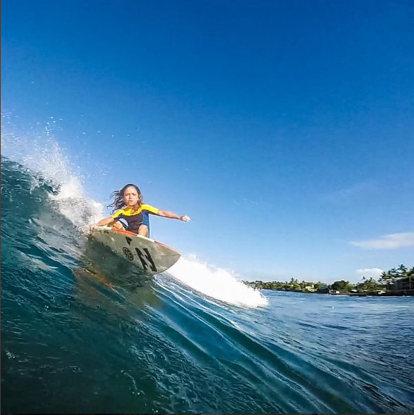 La Increíble Historia Del Hijo De Shane Dorian